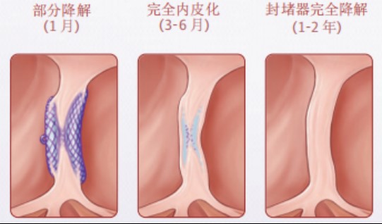 答复关于加快推进“禁限塑令”政策落实支持可降解塑料产业发展的建议(图1)